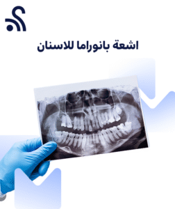 اشعة بانوراما للاسنان