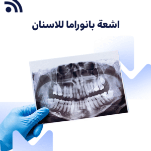 اشعة بانوراما  للاسنان