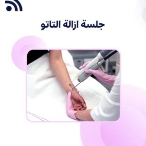 Tattoo Removal Session