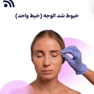 خيوط شد الوجه (خيط واحد)