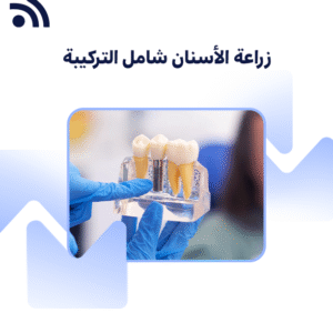 زراعة الأسنان شامل التركيبة