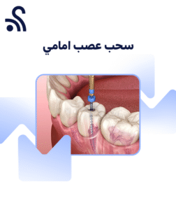 سحب عصب امامي