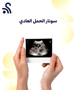 سونار الحمل العادي