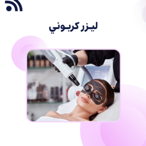 ليزر كربوني